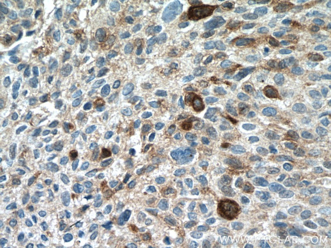 PAI-1 Antibody in Immunohistochemistry (Paraffin) (IHC (P))