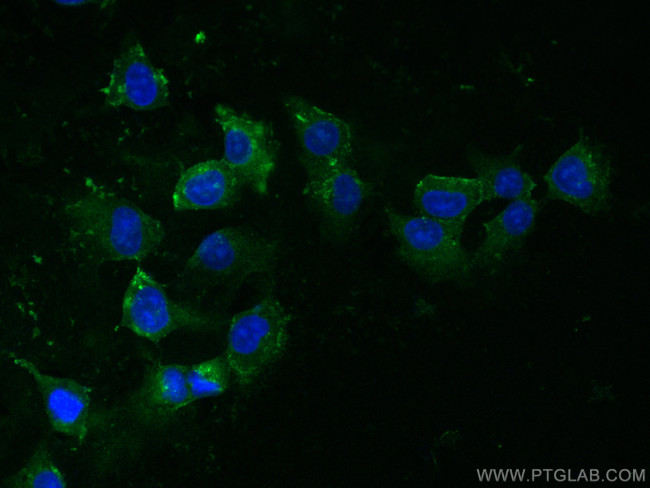 PAI-1 Antibody in Immunocytochemistry (ICC/IF)