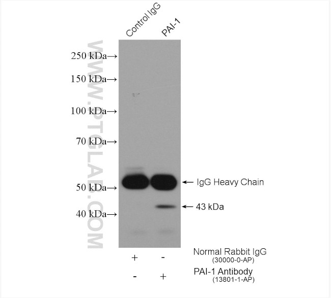 PAI-1 Antibody in Immunoprecipitation (IP)