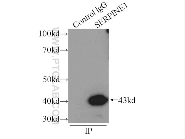 PAI-1 Antibody in Immunoprecipitation (IP)