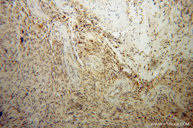 DARS2 Antibody in Immunohistochemistry (Paraffin) (IHC (P))