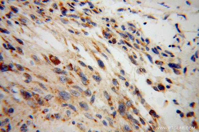 DARS2 Antibody in Immunohistochemistry (Paraffin) (IHC (P))