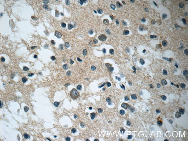 DARS2 Antibody in Immunohistochemistry (Paraffin) (IHC (P))