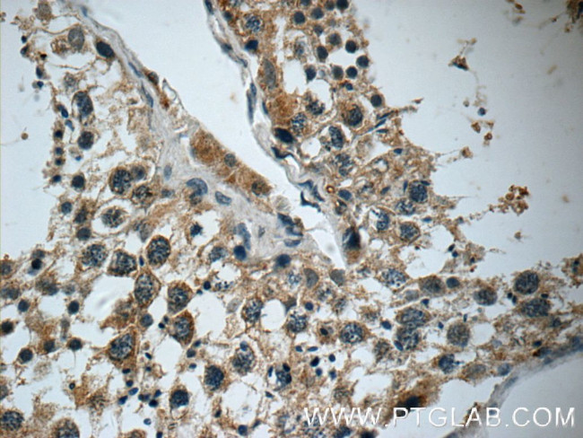 DARS2 Antibody in Immunohistochemistry (Paraffin) (IHC (P))