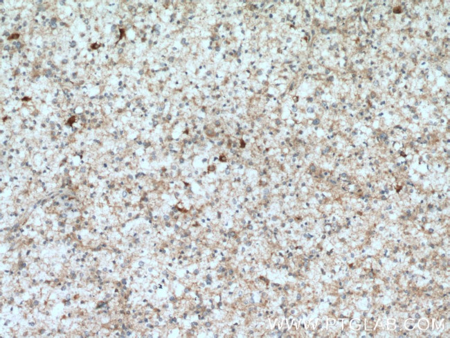 DYNC1I1 Antibody in Immunohistochemistry (Paraffin) (IHC (P))