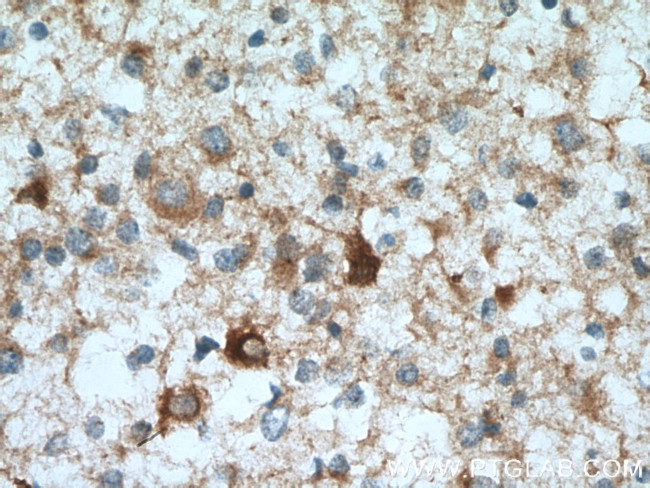 DYNC1I1 Antibody in Immunohistochemistry (Paraffin) (IHC (P))