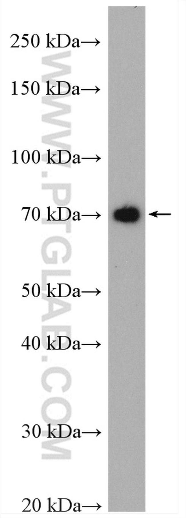 DYNC1I1 Antibody in Western Blot (WB)