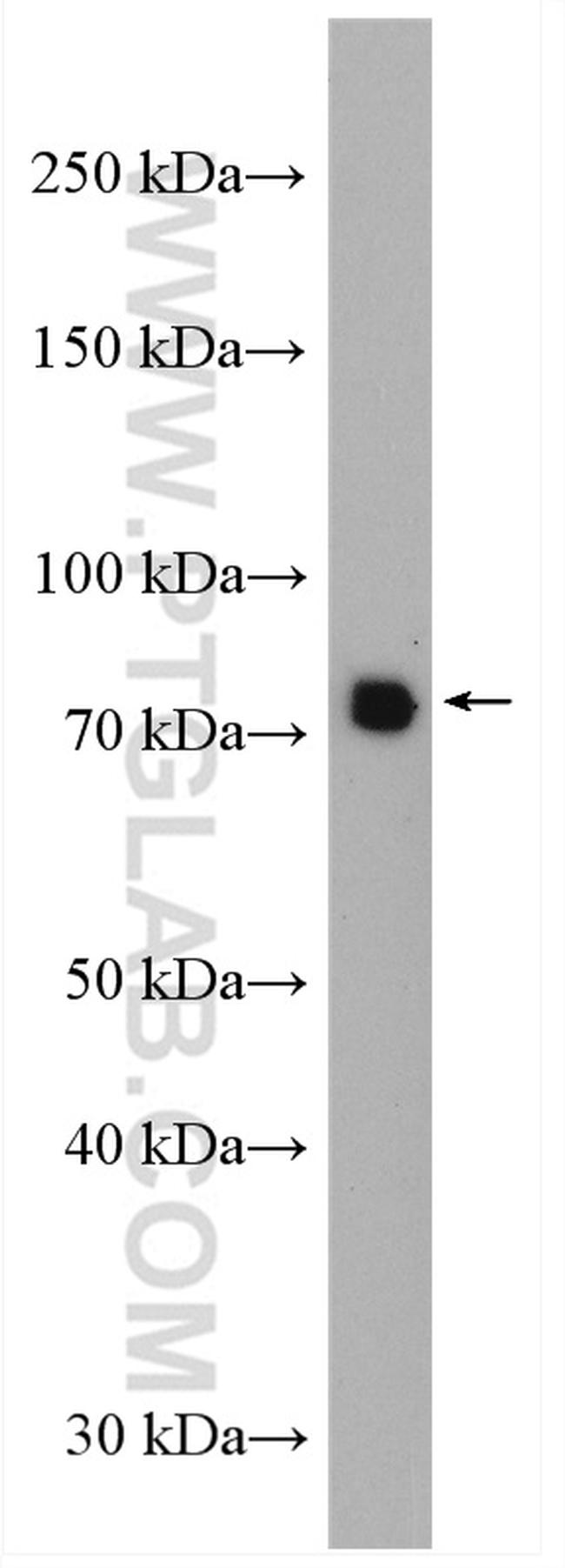 DYNC1I1 Antibody in Western Blot (WB)