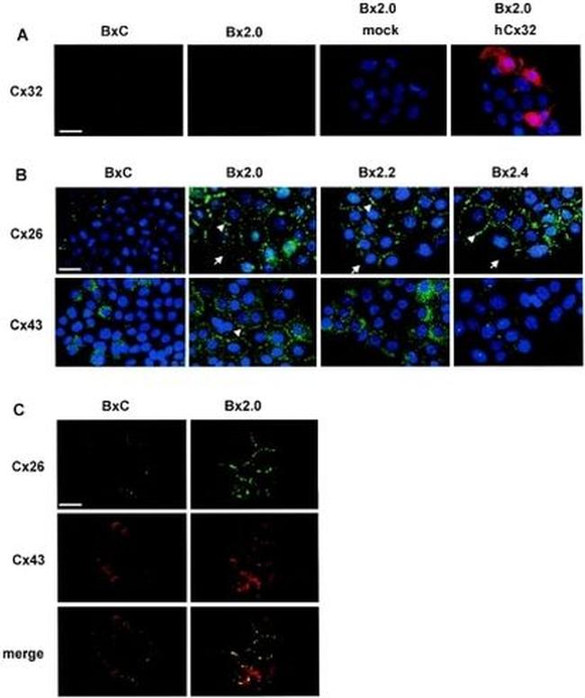 Connexin 26 Antibody in Immunocytochemistry (ICC/IF)