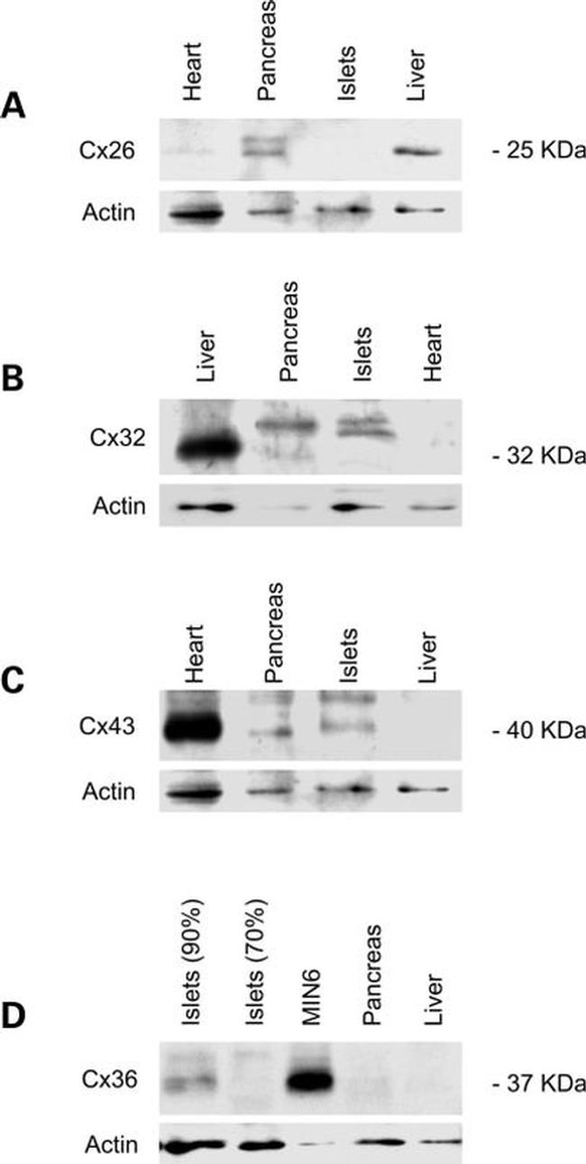 Connexin 26 Antibody in Western Blot (WB)