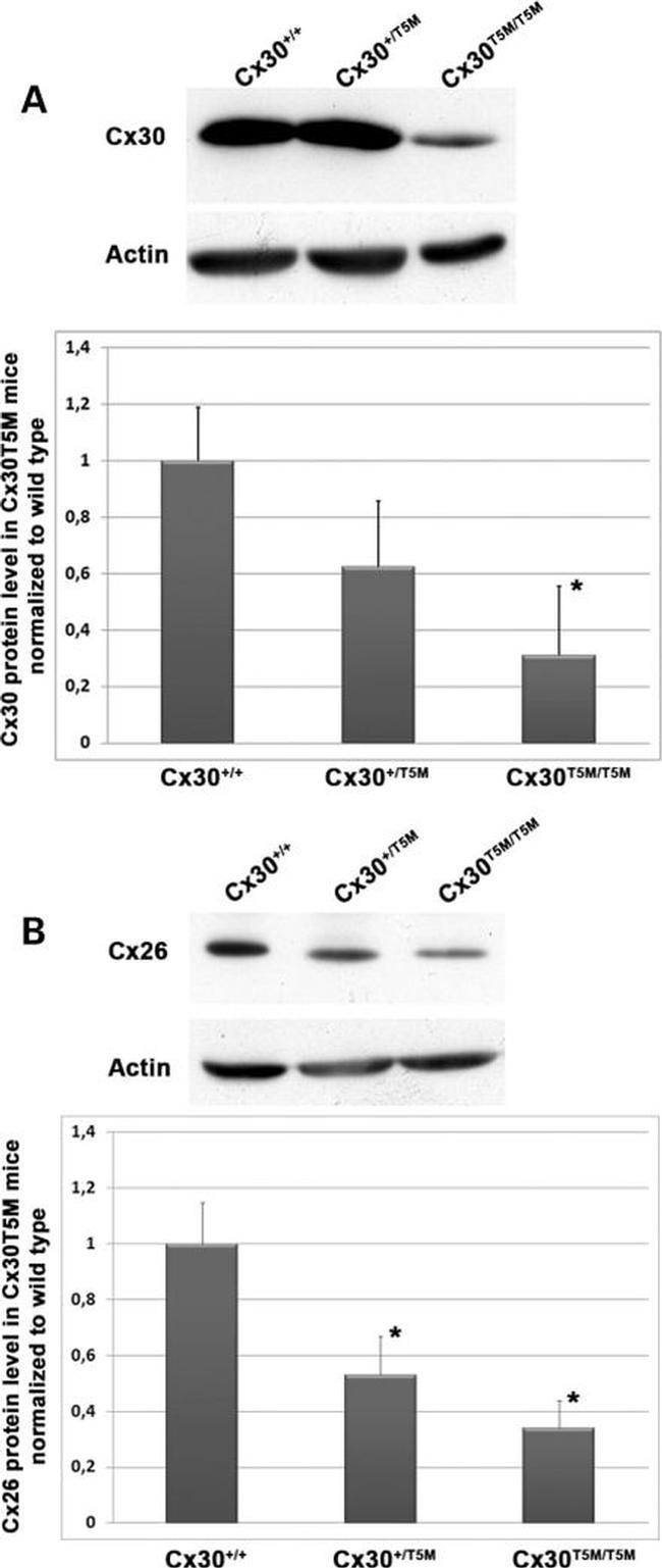 Connexin 26 Antibody in Western Blot (WB)