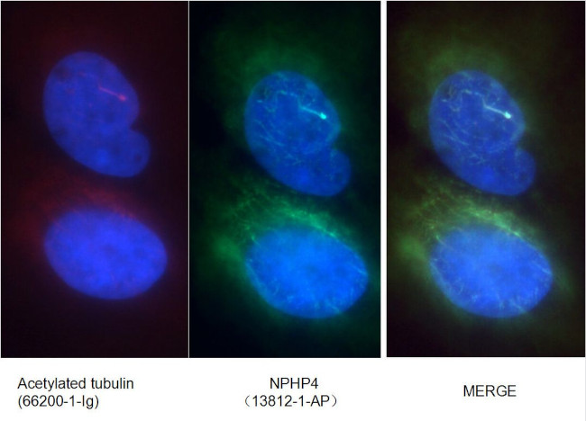 NPHP4 Antibody in Immunocytochemistry (ICC/IF)