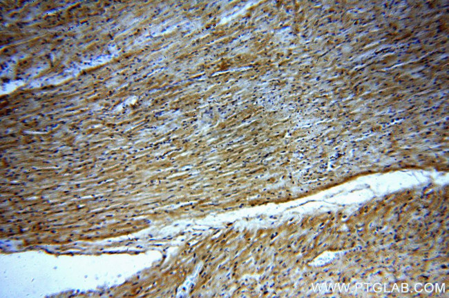 NPHP4 Antibody in Immunohistochemistry (Paraffin) (IHC (P))