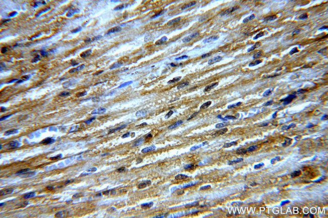 NPHP4 Antibody in Immunohistochemistry (Paraffin) (IHC (P))