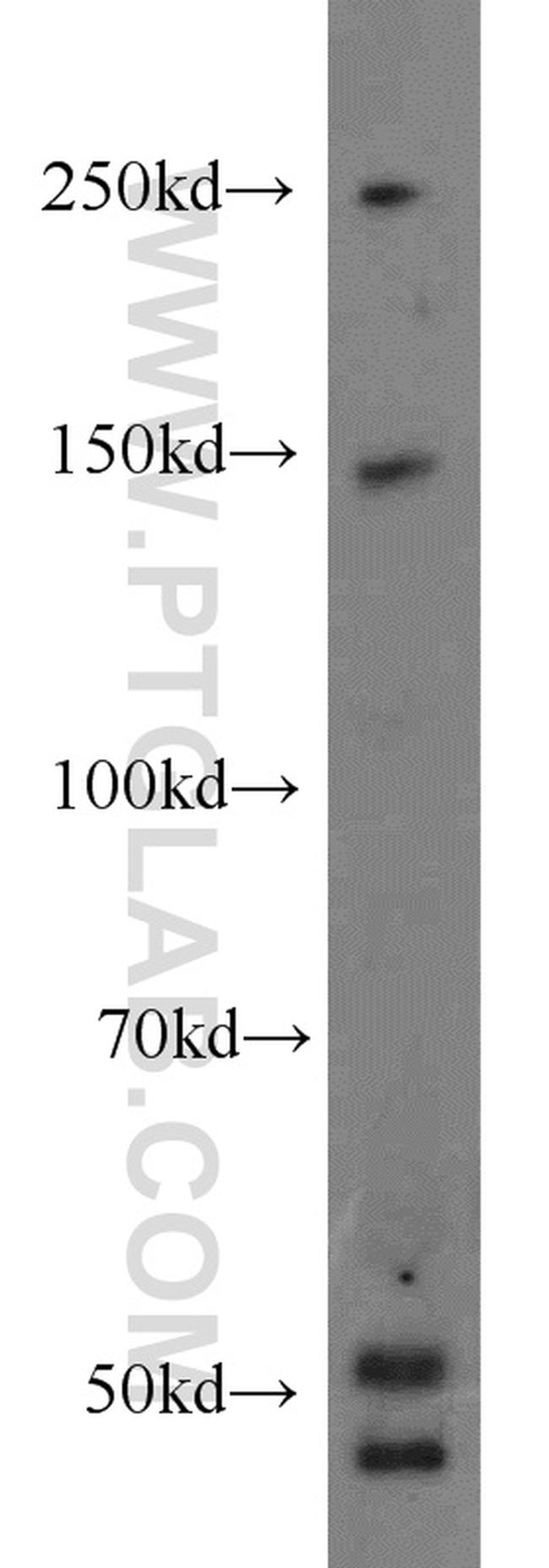 NPHP4 Antibody in Western Blot (WB)