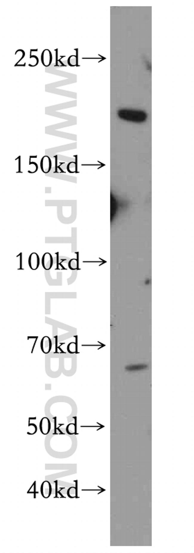 NISCH Antibody in Western Blot (WB)