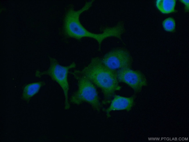 AACS Antibody in Immunocytochemistry (ICC/IF)