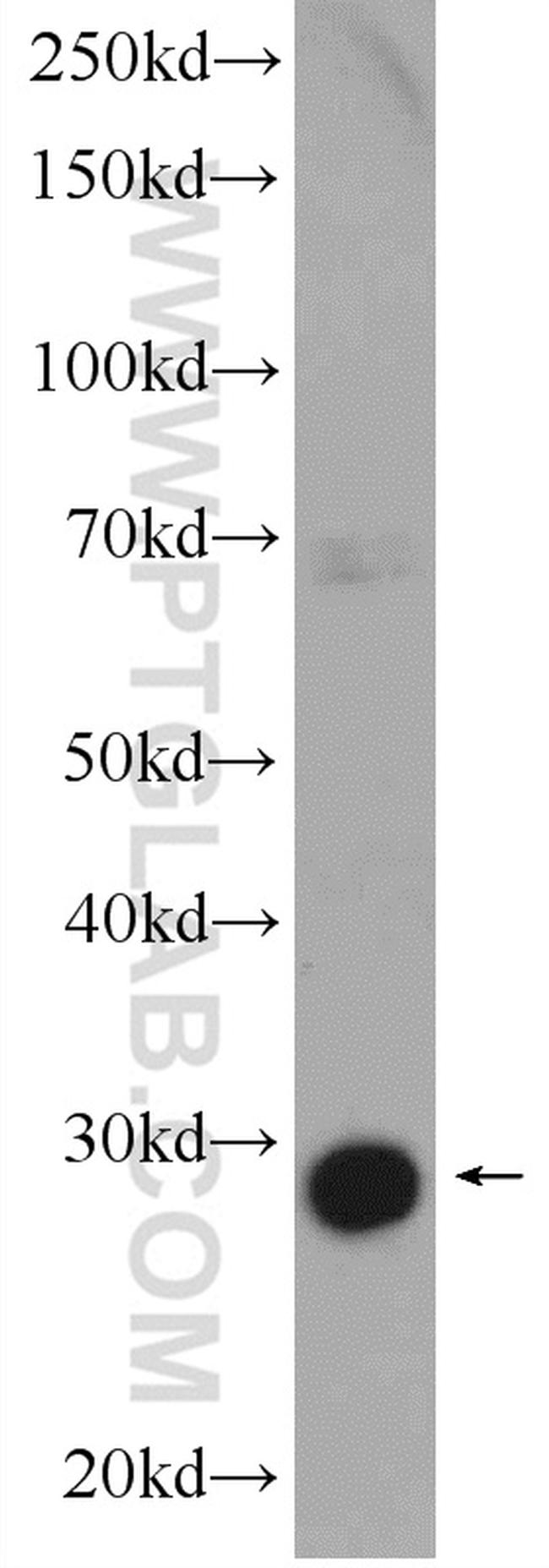 AACS Antibody in Western Blot (WB)