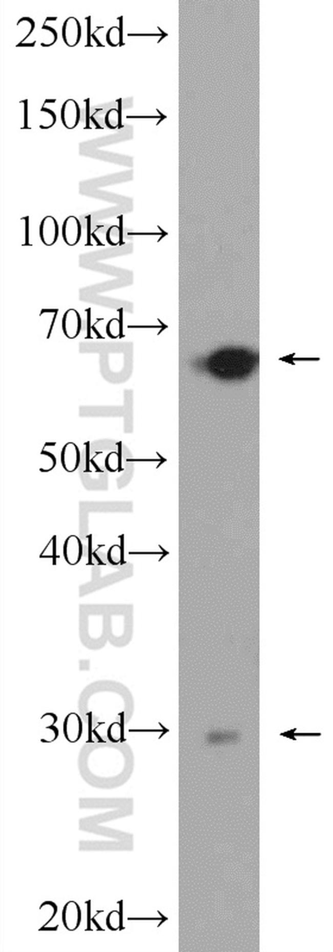 AACS Antibody in Western Blot (WB)