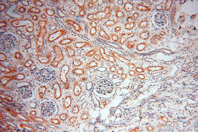 DIXDC1 Antibody in Immunohistochemistry (Paraffin) (IHC (P))