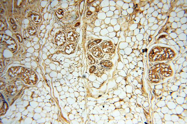 DIXDC1 Antibody in Immunohistochemistry (Paraffin) (IHC (P))