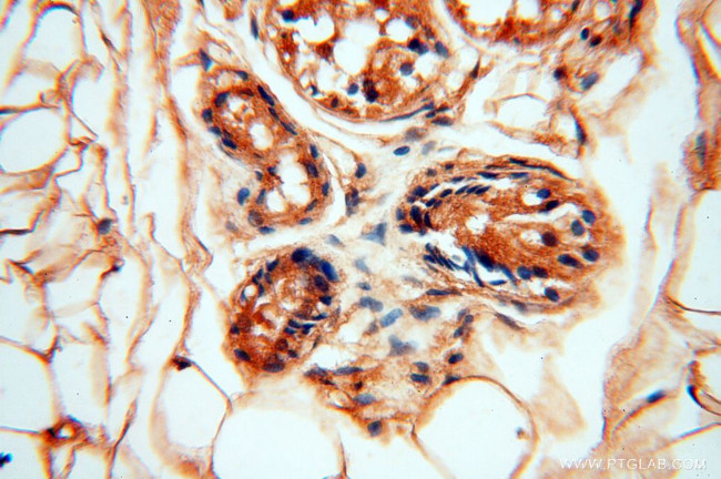 DIXDC1 Antibody in Immunohistochemistry (Paraffin) (IHC (P))