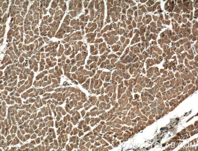 DIXDC1 Antibody in Immunohistochemistry (Paraffin) (IHC (P))