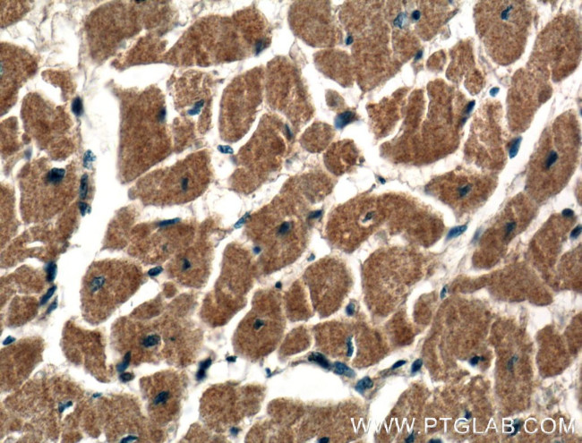 DIXDC1 Antibody in Immunohistochemistry (Paraffin) (IHC (P))