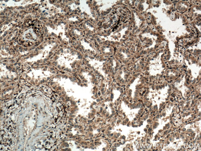 SEPT7 Antibody in Immunohistochemistry (Paraffin) (IHC (P))