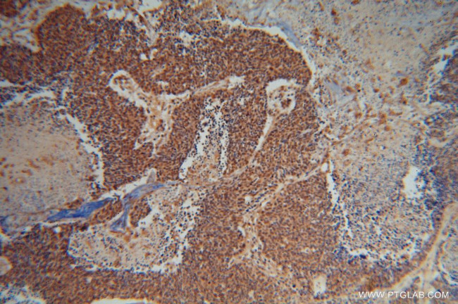 SEPT7 Antibody in Immunohistochemistry (Paraffin) (IHC (P))