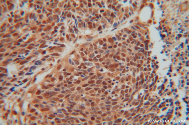 SEPT7 Antibody in Immunohistochemistry (Paraffin) (IHC (P))