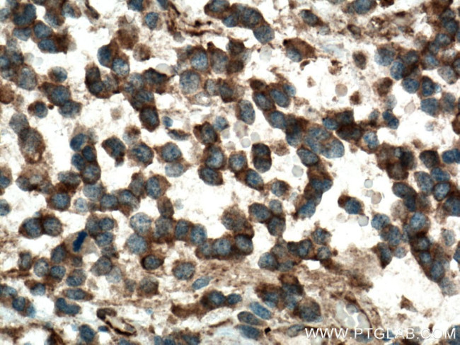 SEPT7 Antibody in Immunohistochemistry (Paraffin) (IHC (P))