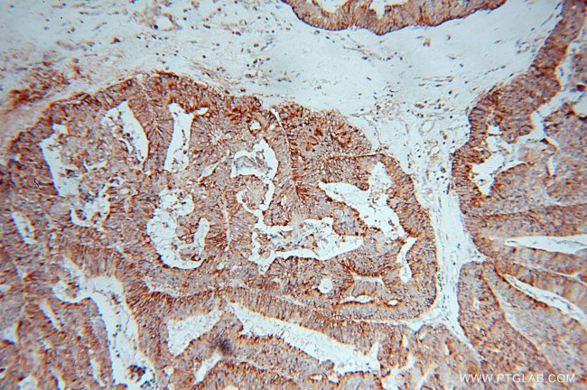 ARTS1 Antibody in Immunohistochemistry (Paraffin) (IHC (P))