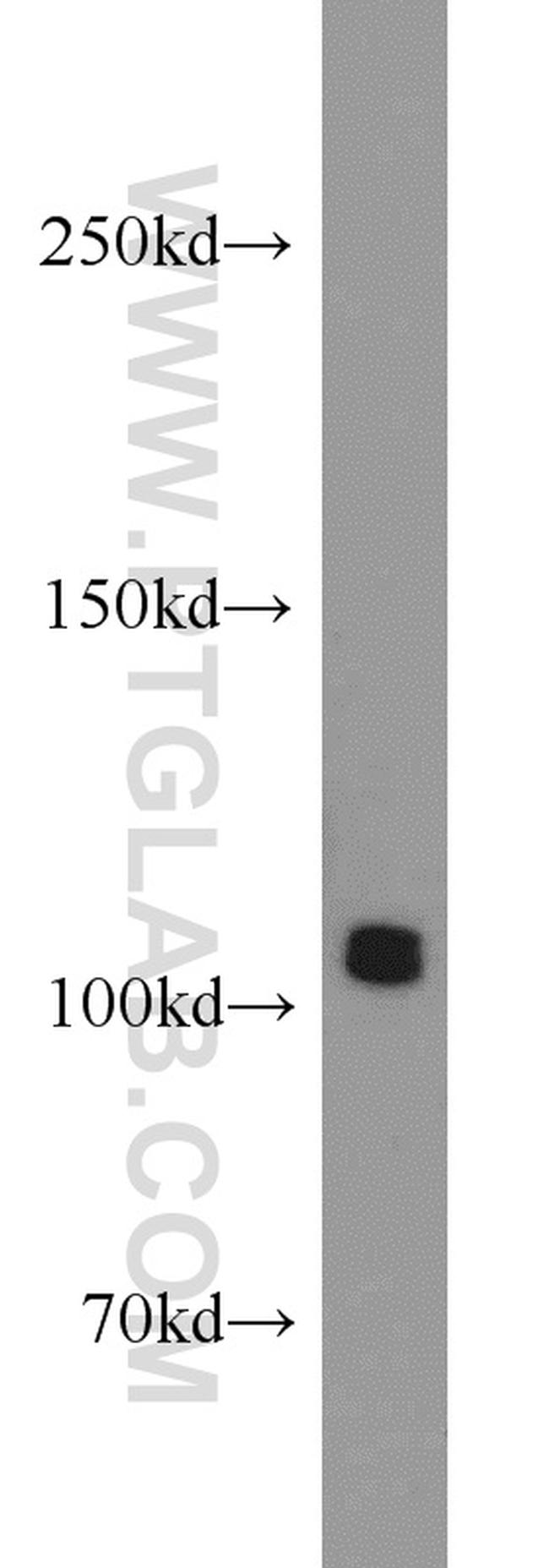 ARTS1 Antibody in Western Blot (WB)