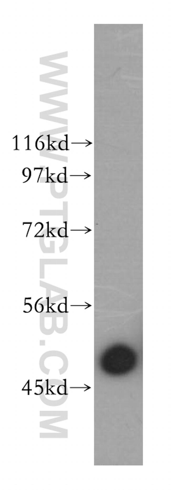 ARP3 Antibody in Western Blot (WB)