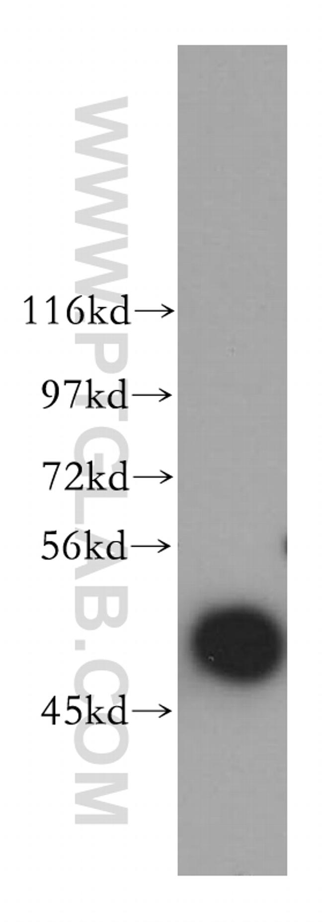 ARP3 Antibody in Western Blot (WB)