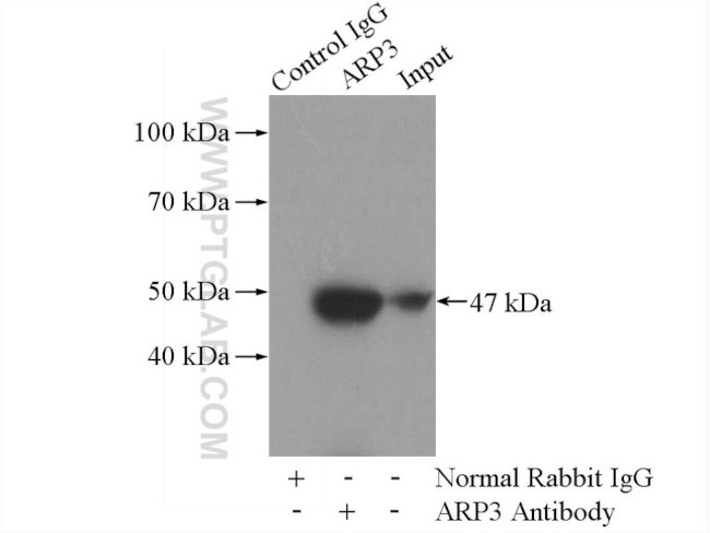 ARP3 Antibody in Immunoprecipitation (IP)