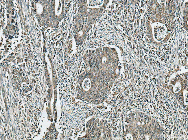 SLC7A6 Antibody in Immunohistochemistry (Paraffin) (IHC (P))
