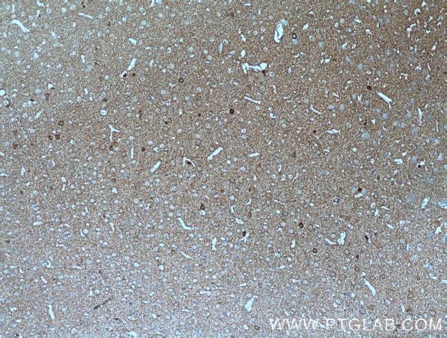 ATP6V0A1 Antibody in Immunohistochemistry (Paraffin) (IHC (P))