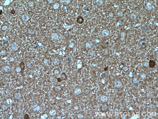 ATP6V0A1 Antibody in Immunohistochemistry (Paraffin) (IHC (P))