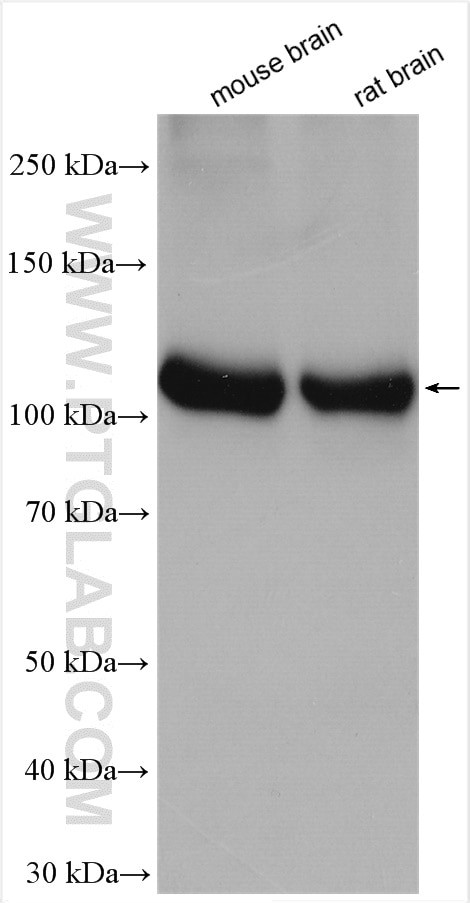 ATP6V0A1 Antibody in Western Blot (WB)