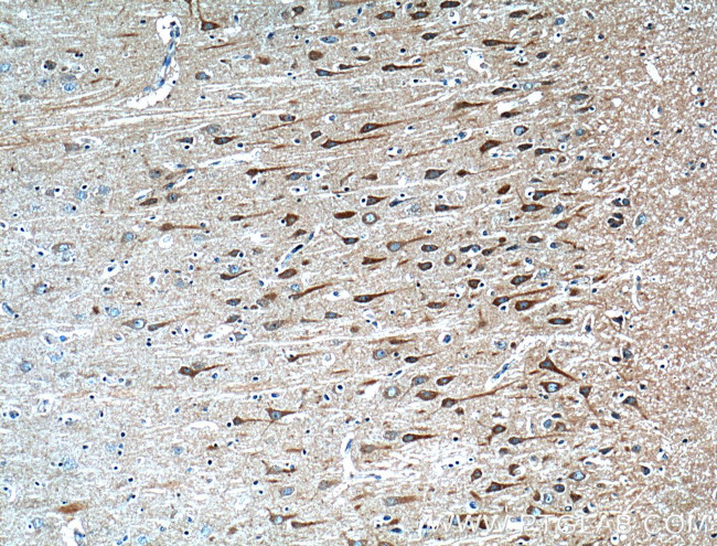 HTR7 Antibody in Immunohistochemistry (Paraffin) (IHC (P))