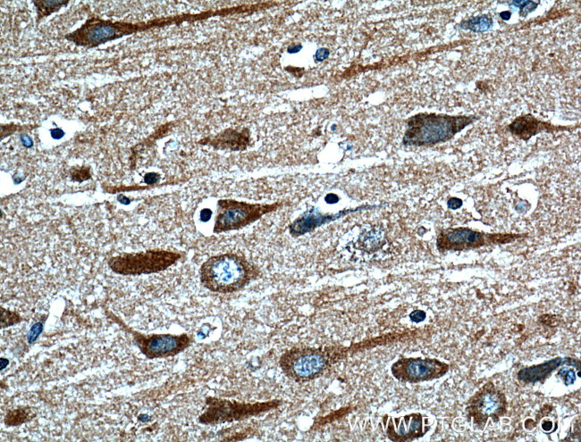 HTR7 Antibody in Immunohistochemistry (Paraffin) (IHC (P))