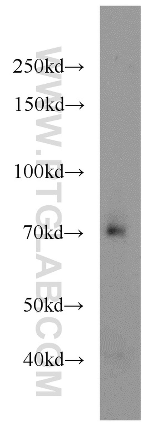 TCF7L2 Antibody in Western Blot (WB)