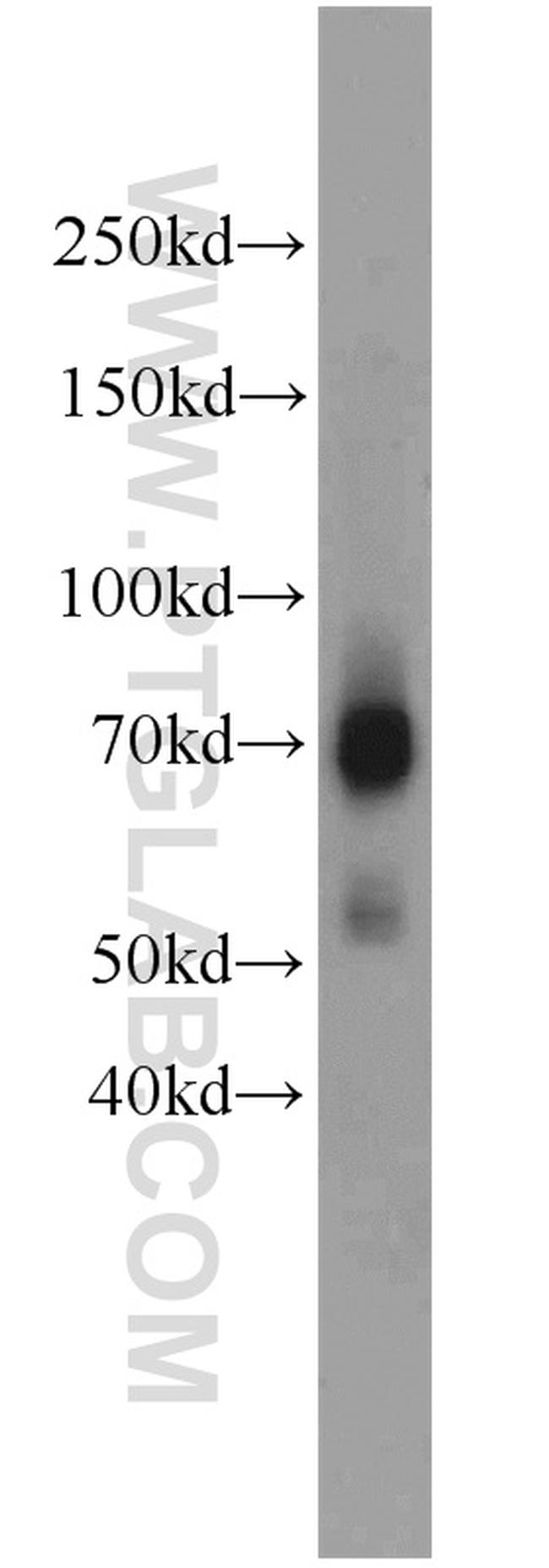 TCF7L2 Antibody in Western Blot (WB)