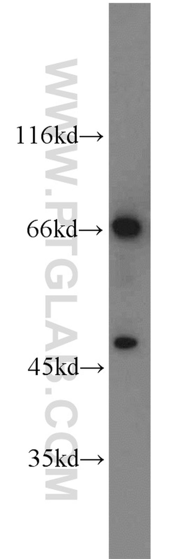 TCF7L2 Antibody in Western Blot (WB)