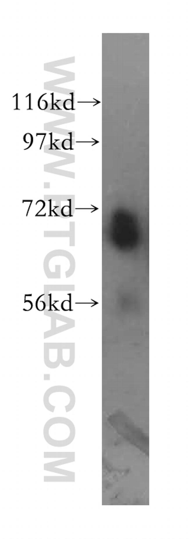 TCF7L2 Antibody in Western Blot (WB)