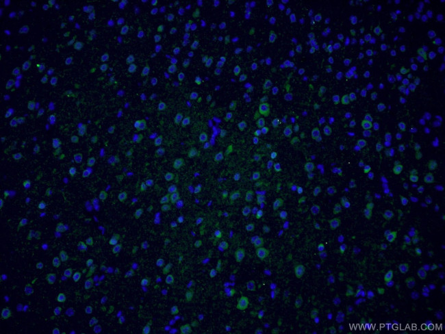 TAC1 Antibody in Immunohistochemistry (PFA fixed) (IHC (PFA))