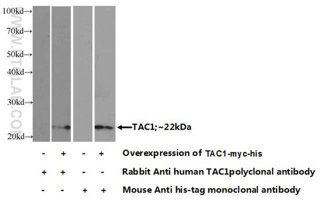TAC1 Antibody in Western Blot (WB)