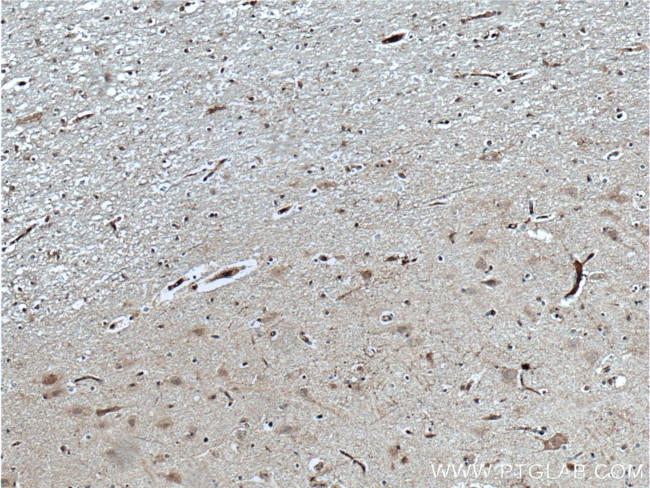 TAC1 Antibody in Immunohistochemistry (Paraffin) (IHC (P))